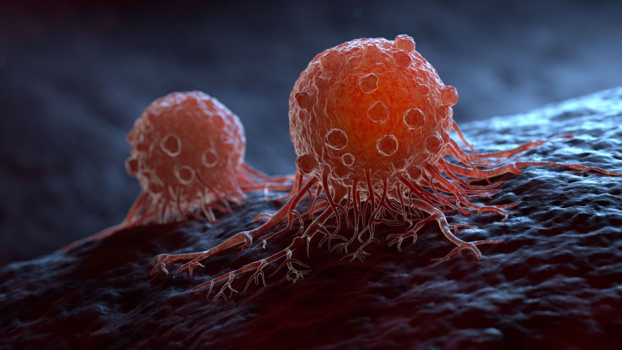 Cancer : un nouveau médicament pour diminuer les métastases et la  résistance à la chimiothérapie - RTBF Actus